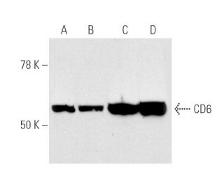 CD6 Antibody (SPV-L14) - Western Blotting - Image 4715 