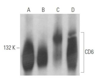 CD6 Antibody (UMCD6/3F7B5) - Western Blotting - Image 15662 