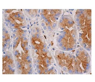 DJ機材 C535EB CD63 Antibody (MX-49.129.5) | SCBT - Santa Cruz Biotechnology