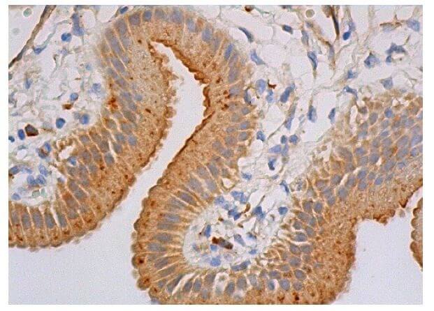 CD63 Antibody (MX-49.129.5) | SCBT - Santa Cruz Biotechnology