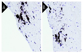 CD68抗体(KP1) | SCBT - Santa Cruz Biotechnology