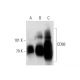 This polyclonal antibody has been discontinued. See our recommended <a href="cd68-antibody-kp1">CD68 (KP1)</a> monoclonal antibody (sample data shown). western blotting image from recommended CD68 (KP1) monoclonal antibody replacement. Image 138543