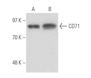 CD71/TFRC/Transferrin Receptor Antibody (b3/25) - Western Blotting - Image 17239