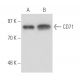 CD71/TFRC/Transferrin Receptor Antibody (b3/25) - Western Blotting - Image 17239