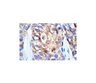 CD71/TFRC/Transferrin Receptor Antibody (DF1513) | SCBT - Santa