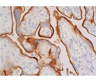 CD71/TFRC/Transferrin Receptor Antibody (G-8) - Immunohistochemistry - Image 369105 