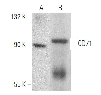 CD71/TFRC/Transferrin Receptor Antibody (G-8) | SCBT - Santa