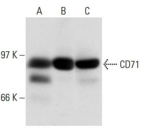 CD71/TFRC/Transferrin Receptor Antibody (YTA 74.4) - Western Blotting - Image 15019 