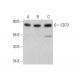 This polyclonal antibody has been discontinued. See our recommended <a href="cd73-antibody-d-12">CD73 (D-12)</a> monoclonal antibody (sample data shown). western blotting image from recommended CD73 (D-12) monoclonal antibody replacement. Image 353237