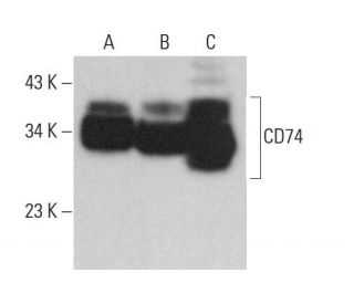 CD74 Antibody (By2) - Western Blotting - Image 379677 