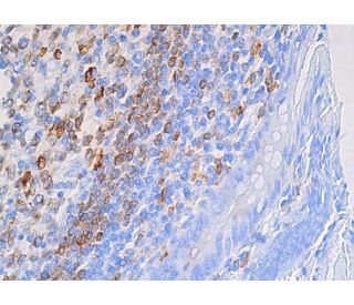 CD74 Antibody (LN-2) | SCBT - Santa Cruz Biotechnology
