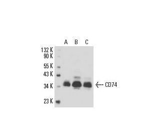 CD74 Antibody (M-B741) - Western Blotting - Image 16359 