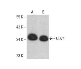 CD74 Antibody (PIN.1) - Western Blotting - Image 352052 