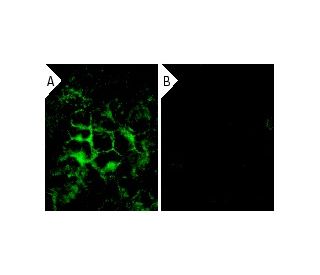 CD74 siRNA (h): sc-35023. Immunofluorescence staining of methanol-fixed, control HeLa (A) and CD74 siRNA silenced HeLa (B) 