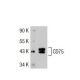 CDw75/ST6GAL1 Antibody (B-L5) - Western Blotting - Image 35243