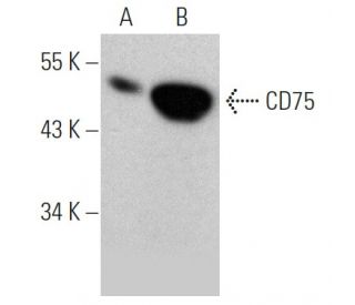 CDw75/ST6GAL1 Antibody (B-L5) - Western Blotting - Image 368236 