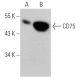 CDw75/ST6GAL1 Antibody (B-L5) - Western Blotting - Image 368236 