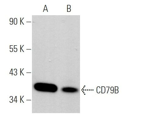 cd79b-antibody-b29-123-western