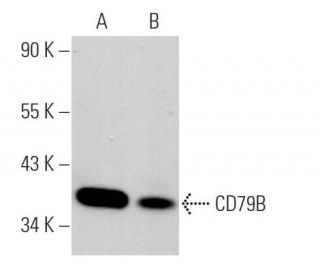 western blotting image from recommended CD79B (B29/123) monoclonal antibody replacement. Image 369286