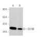 This polyclonal antibody has been discontinued. See our recommended <a href="cd79b-antibody-b29-123">CD79B (B29/123)</a> monoclonal antibody (sample data shown). western blotting image from recommended CD79B (B29/123) monoclonal antibody replacement. Image 369286
