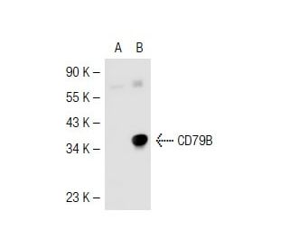 CD79B Antibody (B29/123) - Western Blotting - Image 41685