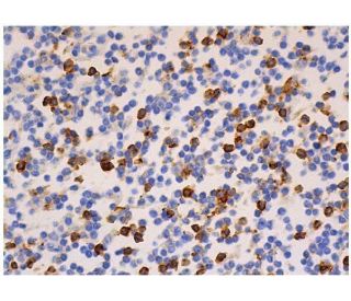 CD8-&alpha; Antibody (0.N.66) - Immunohistochemistry - Image 357555 