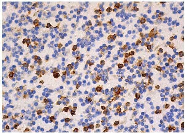CD8-α Antibody (0.N.66) | SCBT - Santa Cruz Biotechnology