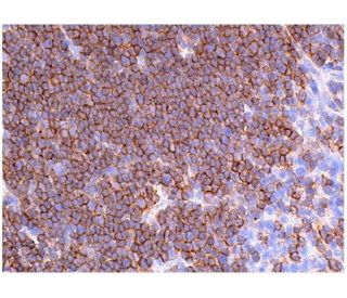 CD8-α Antibody (6A242) | SCBT - Santa Cruz Biotechnology