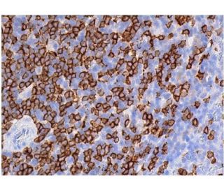 CD8-&alpha; Antibody (6A242) - Immunohistochemistry - Image 357559 