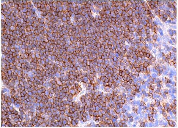 CD8-α Antibody (6A242) | SCBT - Santa Cruz Biotechnology