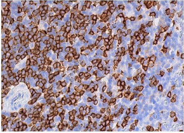 cd8-alpha-antibody-6a242-