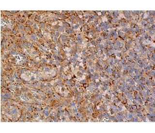 CD8-α Antibody (D-9) | SCBT - Santa Cruz Biotechnology