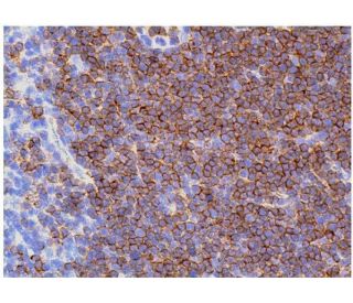 AK　CD8枚セット CD8-α Antibody (OX8) | SCBT - Santa Cruz Biotechnology