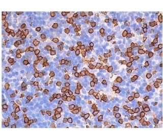 Anti-Alpha-synuclein aggregate 抗体 [MJFR-14-6-4-2