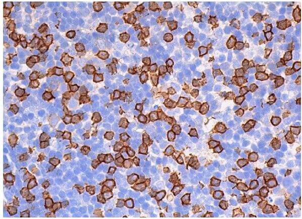 CD8-α Antibody (OX8) | SCBT - Santa Cruz Biotechnology