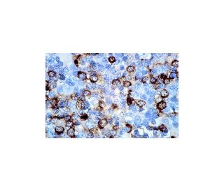 CD8 Antibody (UCH-T4) - Immunohistochemistry - Image 4725 