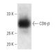 This polyclonal antibody has been discontinued. See our recommended <a href="cd8-beta-antibody-f-5">CD8-β (F-5)</a> monoclonal antibody (sample data shown). western blotting image from recommended CD8-β (F-5) monoclonal antibody replacement. Image 4729