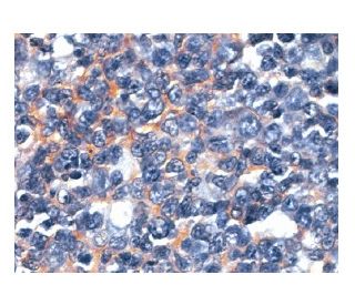 CD81 Antibody (1.3.3.22) | SCBT - Santa Cruz Biotechnology