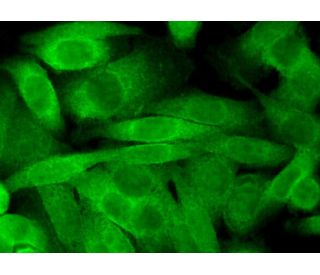 CD81 Antibody (5A6) | SCBT - Santa Cruz Biotechnology