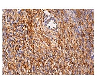 CD81 Antibody (B-11) | SCBT - Santa Cruz Biotechnology