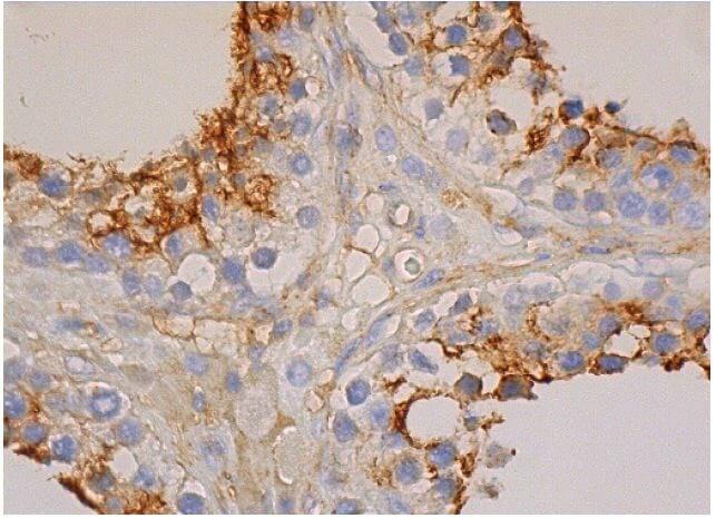 蒼ページ cd81-antibody-b-11-