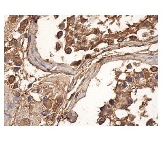 CD83 Antibody (D-3) - Immunohistochemistry - Image 156895 