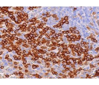 immunohistochemistry image from recommended CD88 (B-6) monoclonal antibody replacement. Image 374090