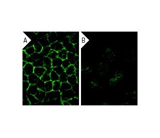 CD9 siRNA (h): sc-35032. Immunofluorescence staining of methanol-fixed, control HeLa (A) and CD9 siRNA silenced HeLa (B) c 