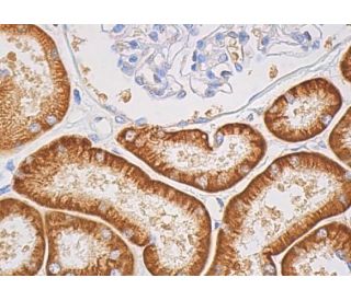 CD98 Antibody (F-2) | SCBT - Santa Cruz Biotechnology
