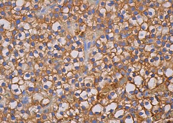 CD98 Antibody (F-2) | SCBT - Santa Cruz Biotechnology