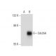 Cdc25A Antibody (5H51) - Western Blotting - Image 133830 