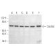 This polyclonal antibody has been discontinued. See our recommended <a href="cdc25a-antibody-f-6">Cdc25A (F-6)</a> monoclonal antibody (sample data shown). western blotting image from recommended Cdc25A (F-6) monoclonal antibody replacement. Image 353936