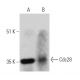 Este anticuerpo policlonal ha dejado de fabricarse. Consulta nuestro anticuerpo monoclonal recomendado <a href="cdc28-antibody-g-7">Cdc28 (G-7)</a> (se muestran datos de muestra). western blotting image from recommended Cdc28 (G-7) monoclonal antibody replacement. Image 363284