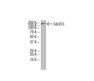 Cdc2L5 Antibody (ZZ08) - Western Blotting - Image 33485SAM Transcription Activation: SAM system utilizing dCas9-VP64, MS2-P65-HSF1, and sgRNA for precise gene transcription activation.